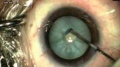 Thumbnail for version as of 11:33, May 31, 2020