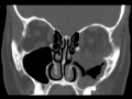 Thumbnail for version as of 17:33, February 14, 2021