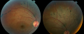 Thumbnail for version as of 20:16, October 24, 2015