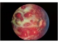 Thumbnail for version as of 10:49, September 29, 2013