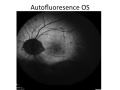 Thumbnail for version as of 11:55, June 17, 2012
