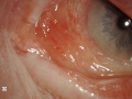 Thumbnail for version as of 01:08, June 5, 2011