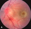 Thumbnail for version as of 17:36, November 3, 2011