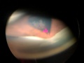 Thumbnail for version as of 14:51, September 3, 2019
