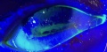 Thumbnail for version as of 10:34, April 29, 2017