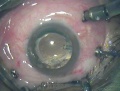 Thumbnail for version as of 11:10, November 13, 2011