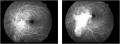 Thumbnail for version as of 19:41, December 1, 2010