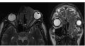 Thumbnail for version as of 11:45, April 30, 2020