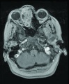 Thumbnail for version as of 20:13, June 1, 2011