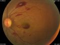 Thumbnail for version as of 18:54, May 13, 2021