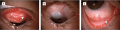 Thumbnail for version as of 06:52, April 11, 2019