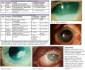 Thumbnail for version as of 18:00, November 30, 2012