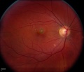 Thumbnail for version as of 18:38, November 30, 2011