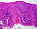 Thumbnail for version as of 06:42, July 5, 2010