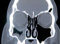 Thumbnail for version as of 22:23, November 29, 2013
