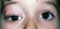 Thumbnail for version as of 19:55, June 1, 2011