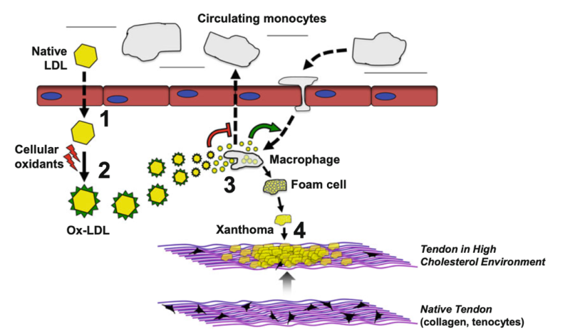File:Figure1pathophys.png