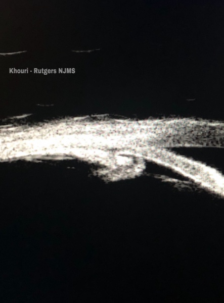 File:E33E23C7-3D9F-46EE-9824-7FA6C9F854D6.JPEG