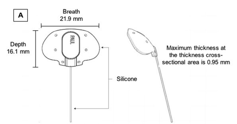 File:Paul Glaucoma Implant.png