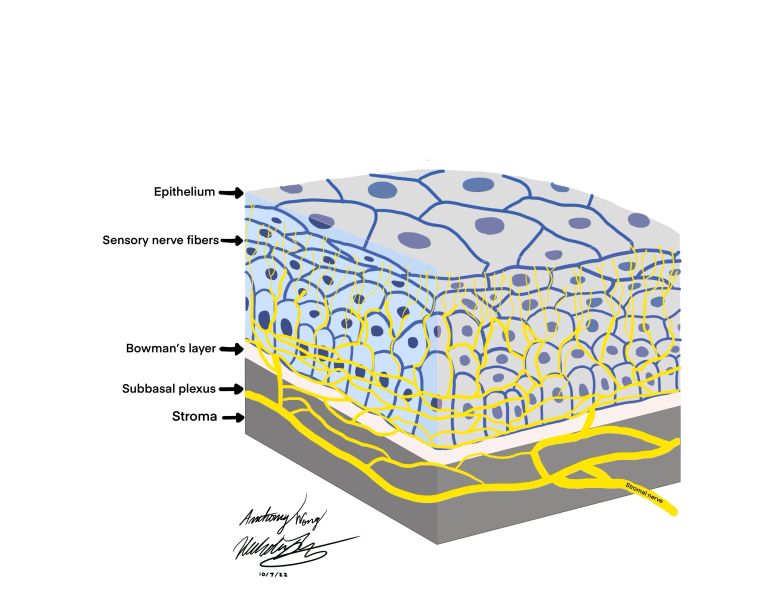 File:Corneal nerves.jpg