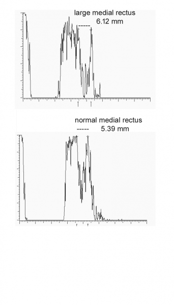 File:Fig 6a Ascan EOM.png