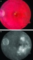 Thumbnail for version as of 23:05, November 30, 2011
