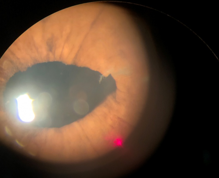 File:Final Zoom.JPG