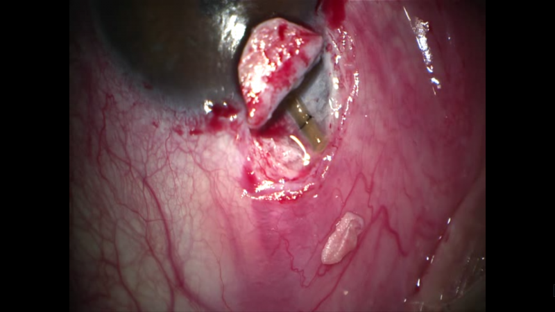 File:Fig 7 anamiguel.png
