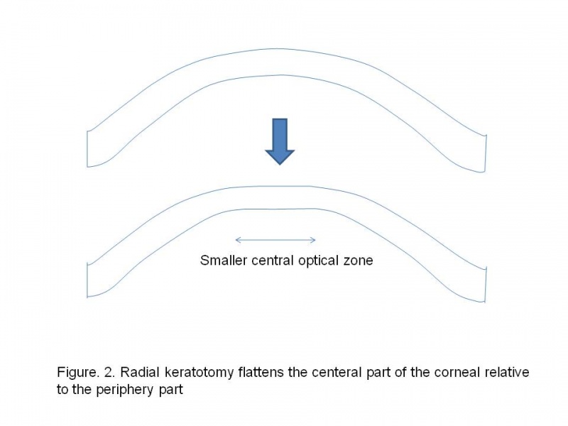 File:P2 iol cal.JPG