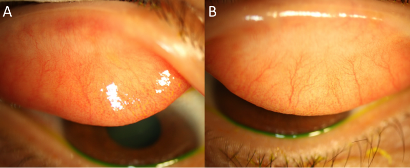 File:Dupilubmab figure 1.png