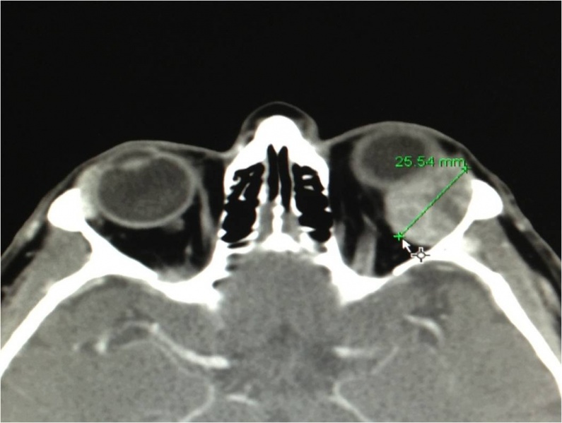 File:CT PALG Figure 2.jpg