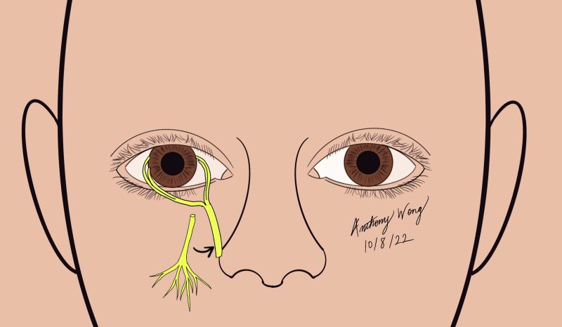 File:Direct infraorbital.jpg