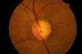 Thumbnail for version as of 18:43, June 14, 2010