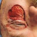 Thumbnail for version as of 08:51, April 22, 2023