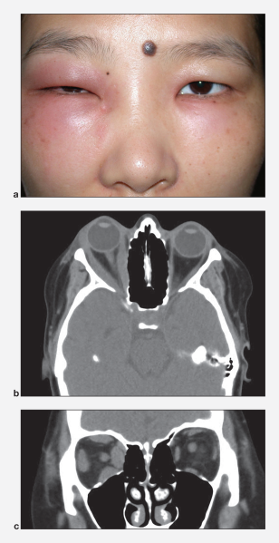 File:FP3005f01.png