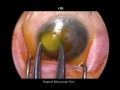 Thumbnail for version as of 10:58, April 12, 2012