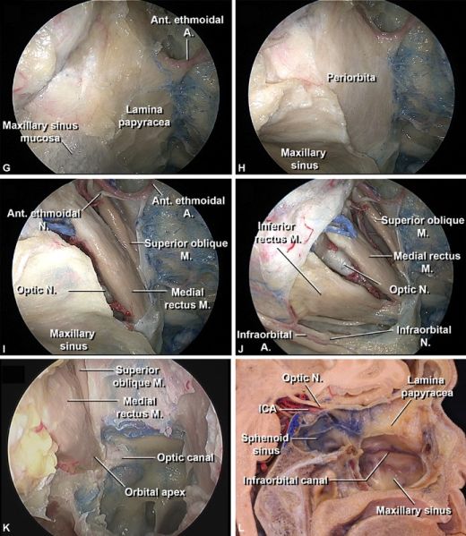 File:Orbital anatomy endo nasal perspective.jpg