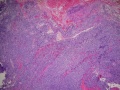 Thumbnail for version as of 19:58, June 1, 2011