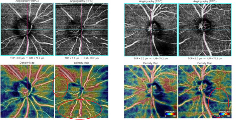 File:Fig 8.2 anamiguel octa improvement.png