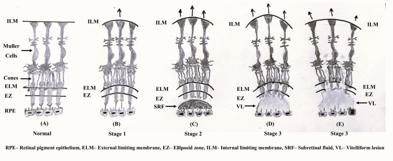 File:Pathophysiology of CB abnormalities.jpg