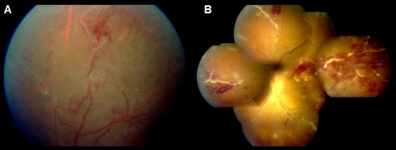 File:Figure TB.jpg