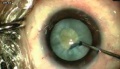 Thumbnail for version as of 11:34, May 31, 2020