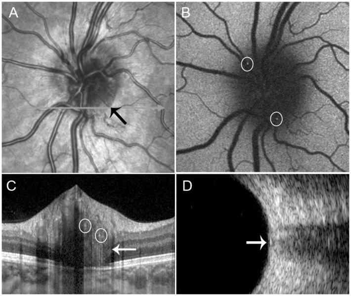 File:PHOMS multimodal imaging.png