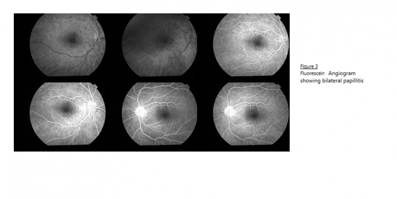 File:Angiogram.png