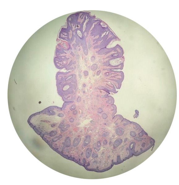 File:Histopathology.jpg