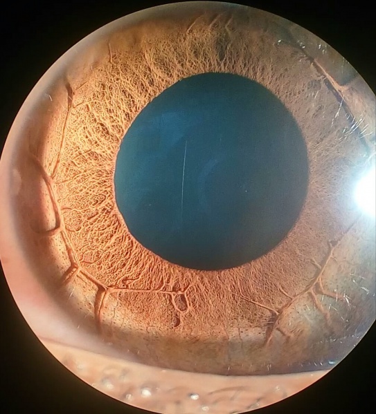 File:Plateau iris.jpg