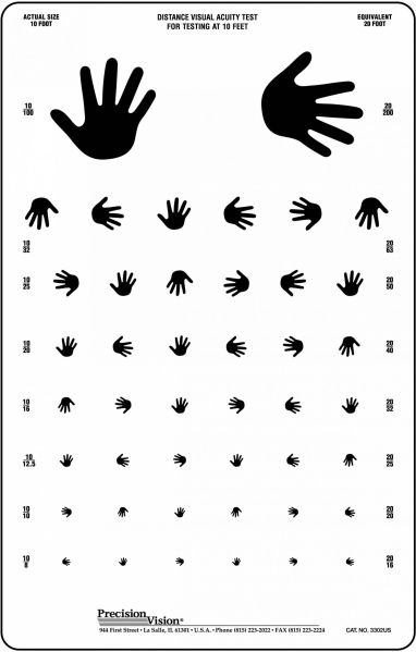 File:Sjogren's hand test.jpg