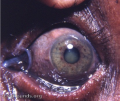 Thumbnail for version as of 11:16, March 10, 2023