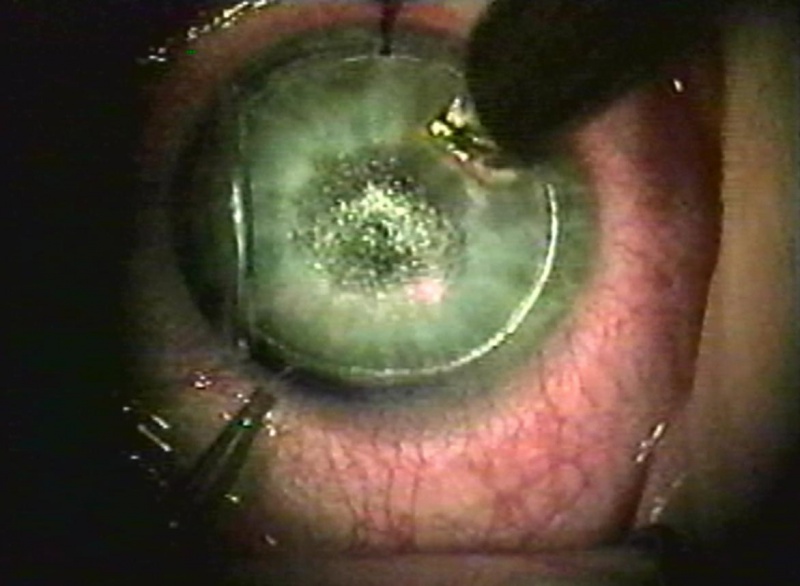 File:Kaufman 18.jpeg