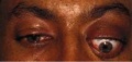 Thumbnail for version as of 20:21, January 5, 2012